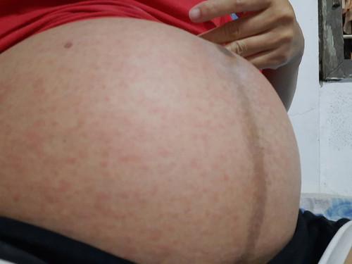 30 week