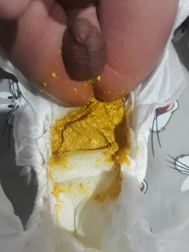 poop bi baby ?