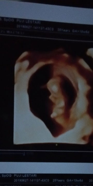 Lim Na Ran profile icon