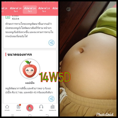 แชร์ประสบการณ์