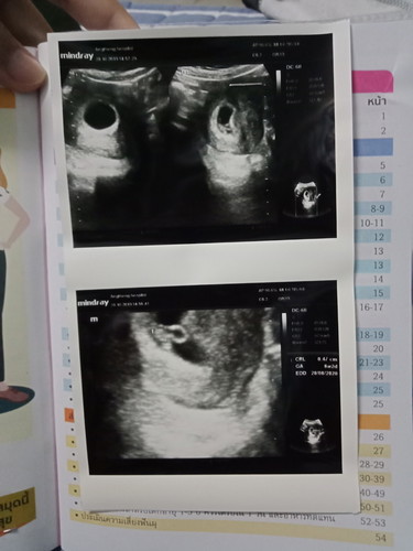 ฝากท้อง