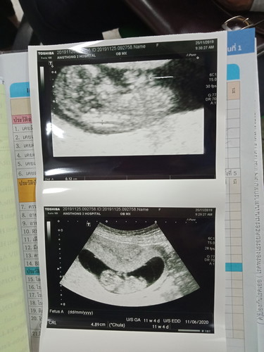 ขอดูใบซาวด์ของคุณแม่บ้านอื่นหน่อยจ้ากี่wกันแล้ว