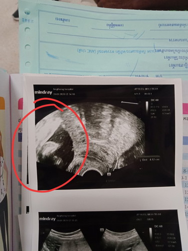 ซาวด์แล้ว5เดือน