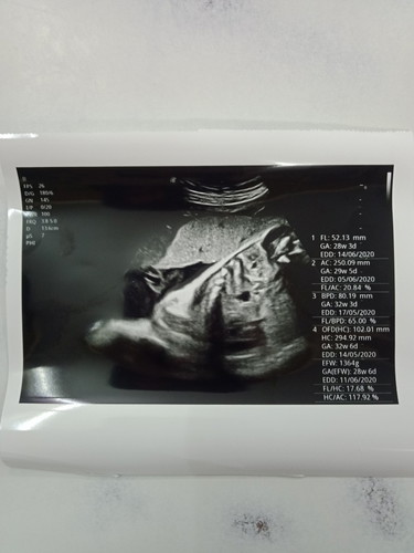 ขอดูใบซาวด์แม่ๆบ้านอื่นหน่อยค่ะ