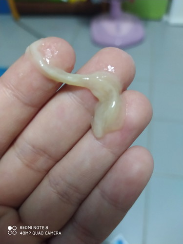 แบบนี้คือมูกใช่ไหมคะเพิ่งโดนกระตุ้นปากมดลูกไป38w2d
