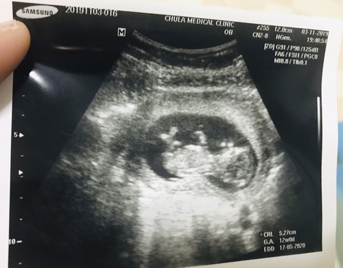 13w ดิ้นเก่งสงสัยหิว แม่นะหิว?