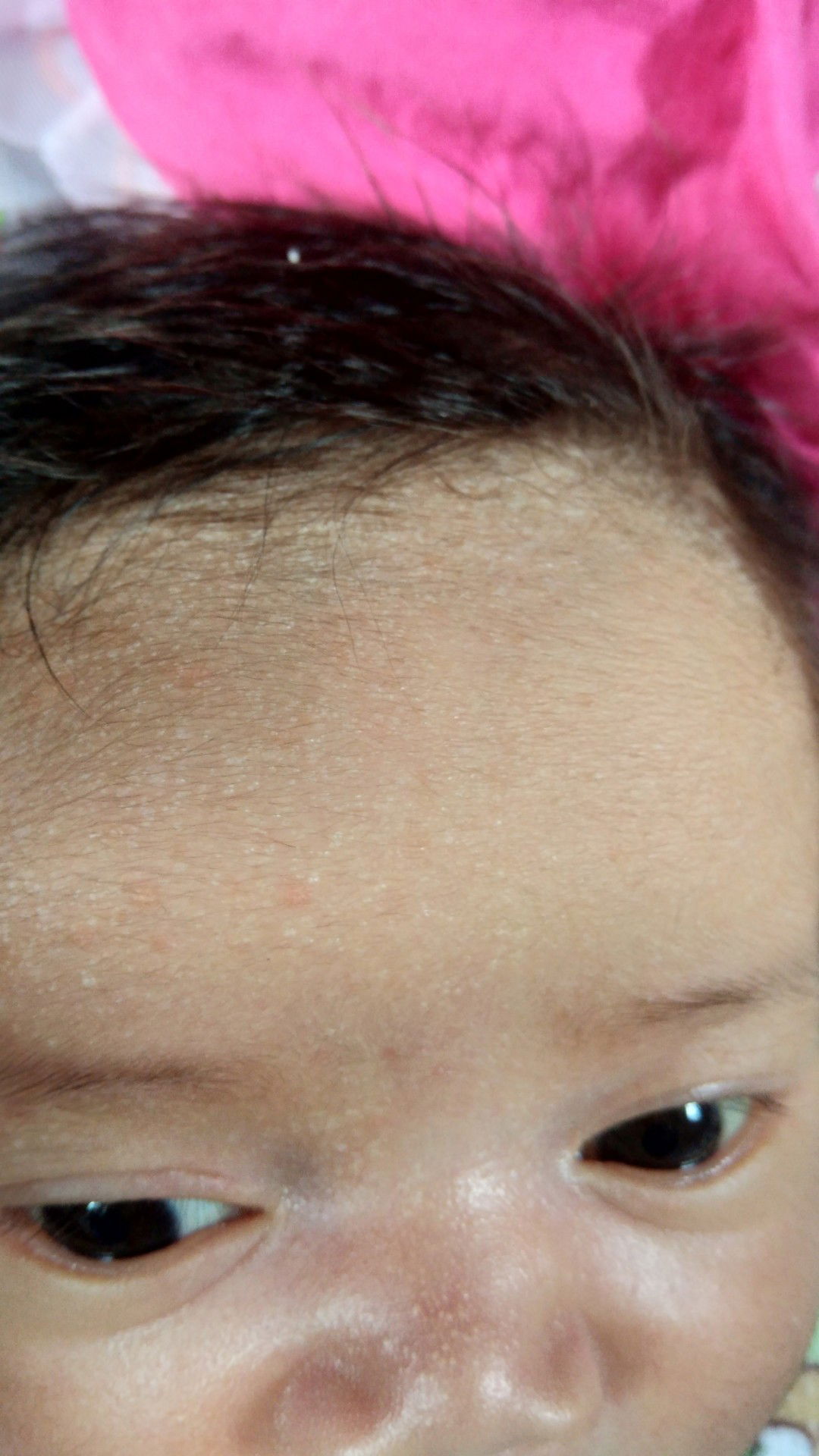 kulit bayi muncul bintik2 putih