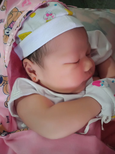 Cord Coil Baby : Normal Delivery