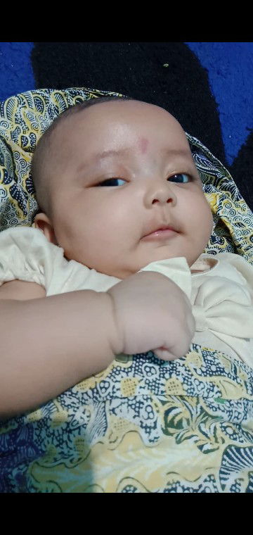 apakah bayi bisa obesitas