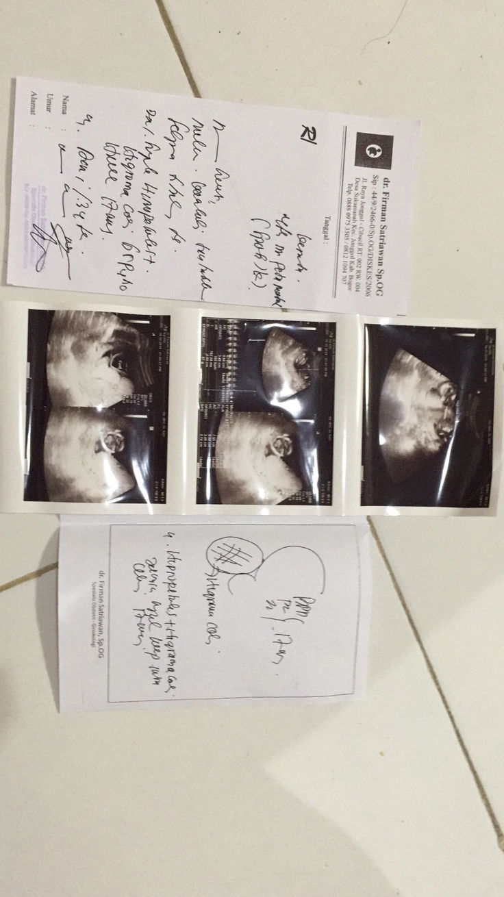 Terdeteksi ada kelainan