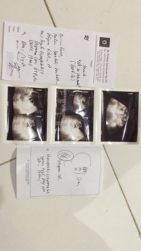 Terdeteksi ada kelainan