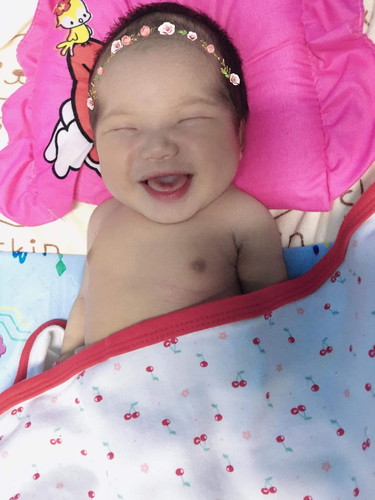 ผ่าคลอด40+1Weeks
