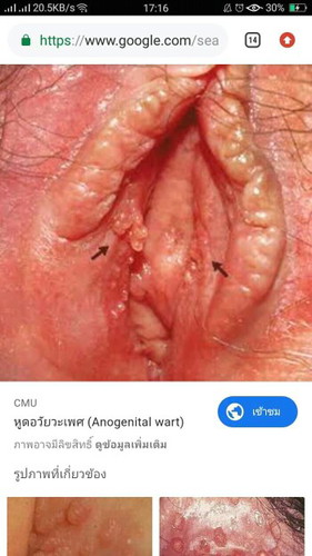 ขออภัยหากภาพน่าเกลียด