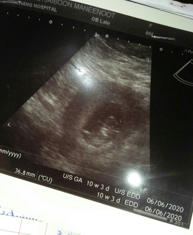 13 w หรือ 10 w