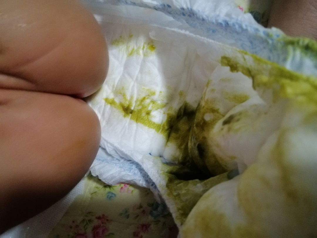 green Poop
