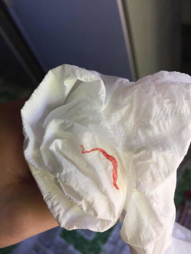 เลือดออกเเบบนี้