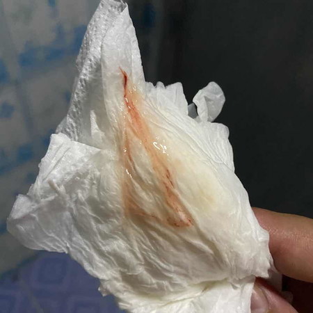 สอบถามเเม่ๆ