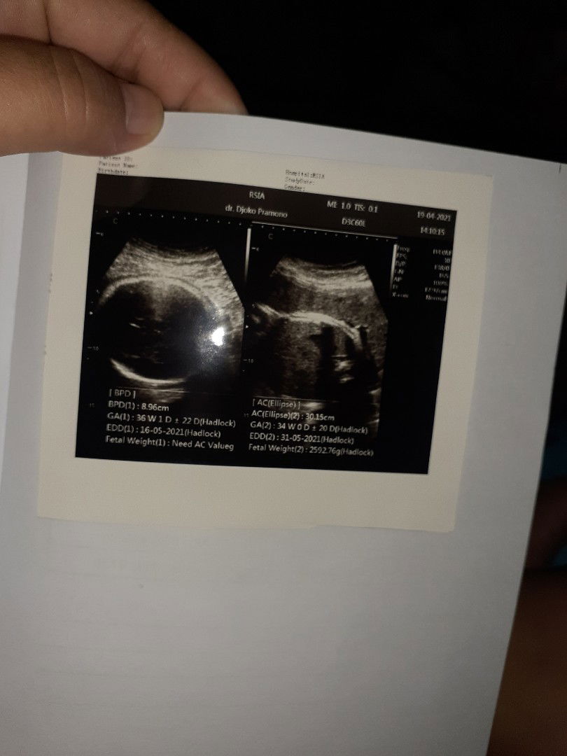 Nur Linda profile icon