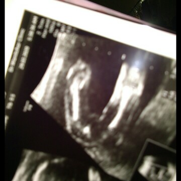 ลูกกก