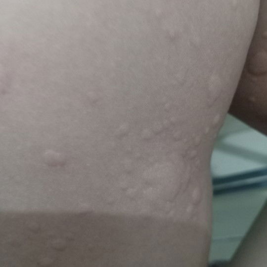 BENTOL BANYAK TIAP PAGI