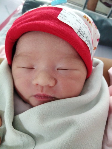 คลอดก่อนกำหนด