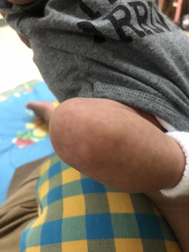 สอบถามเรื่องผิวของลูกค่ะ