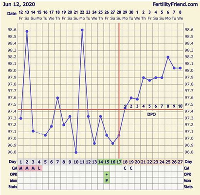 Bbt