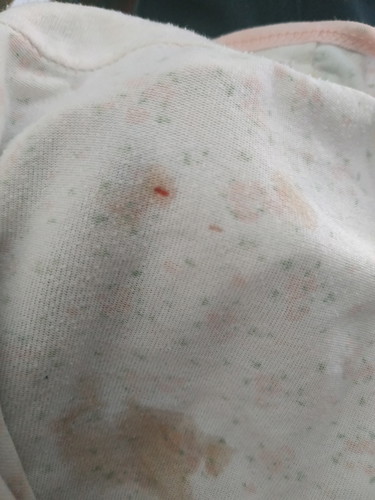 ท้อง 5 week มีเลือดออก