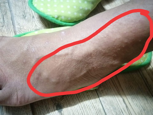 มีใครเป็นบ้างค่ะ