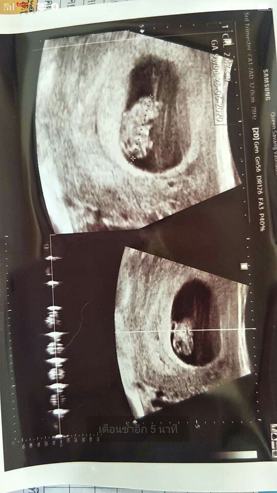 nitipat profile icon