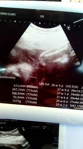 27w+3