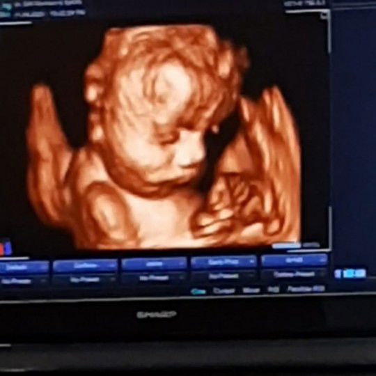 nuri yani profile icon