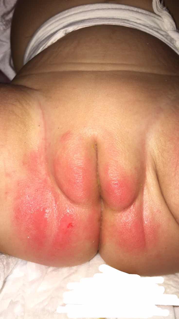 not sure kung rushes ba siya