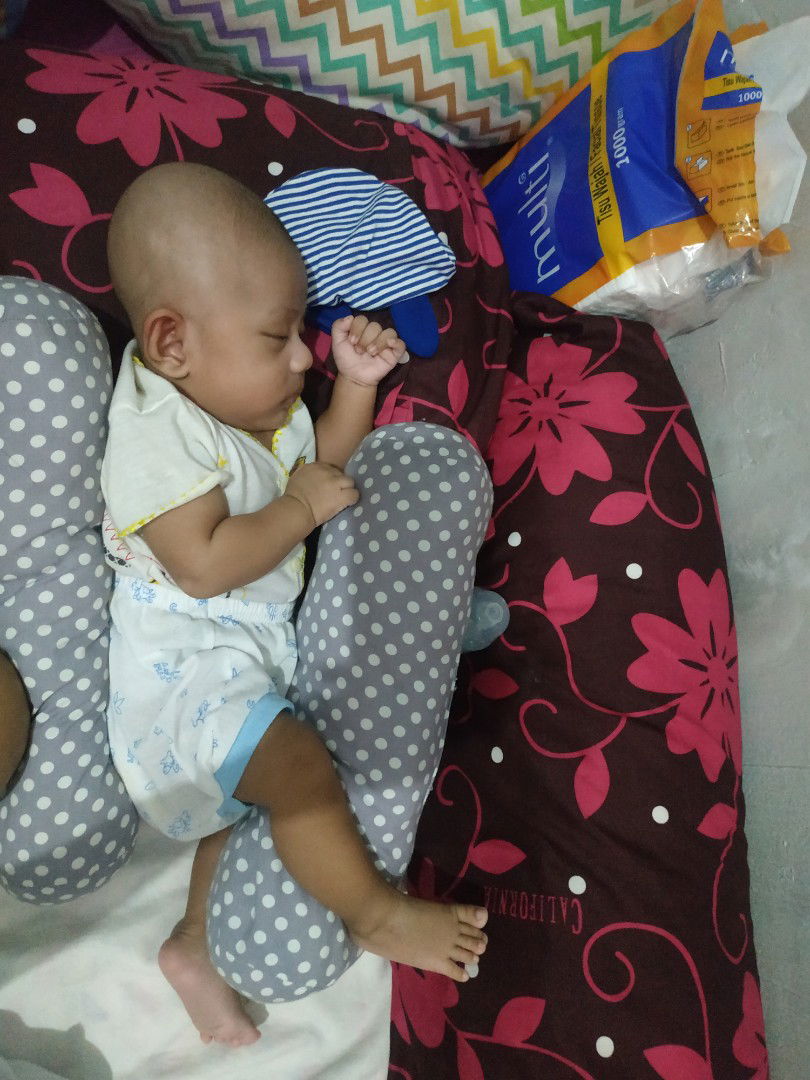 kepala bayi lonjong