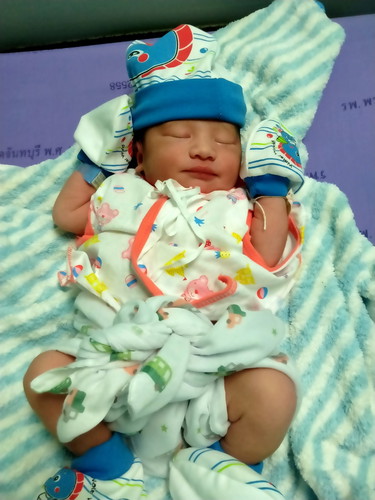 คลอดเเล้ว39วีค เเชร์ประสบการณ์