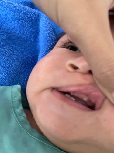 ฟันขึ้นตรงนี้คืออะไรคะ??