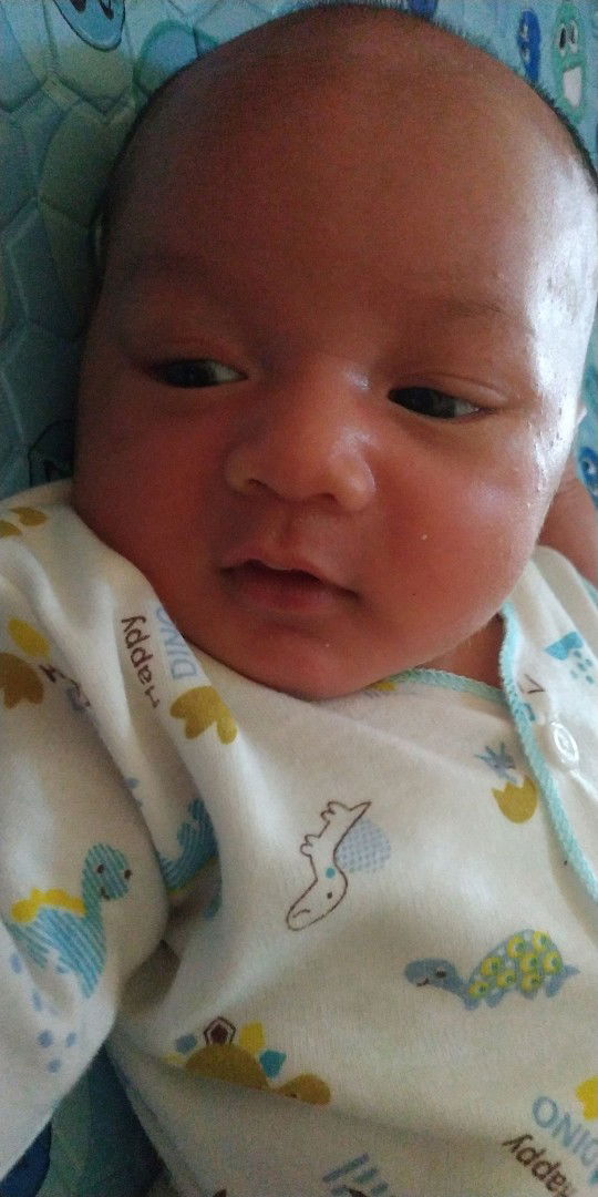 bagian mata terkadang kuning