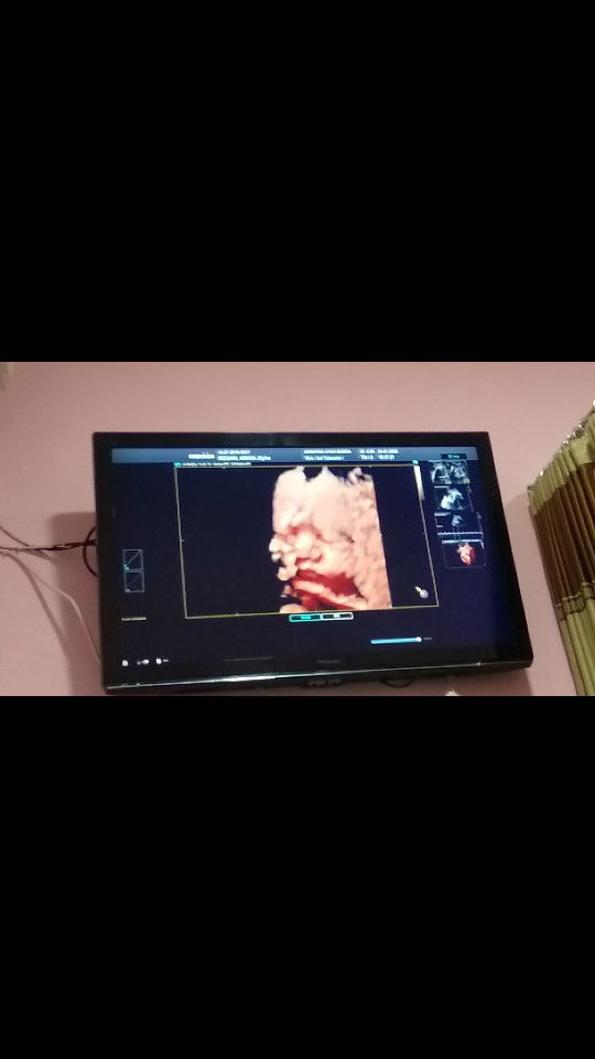 patah hati nya seorang ibu macam aku