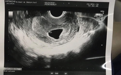 เสียใจมาก