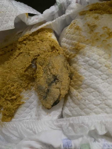 Black stuff in poop