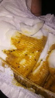 Breastfed Baby Poop
