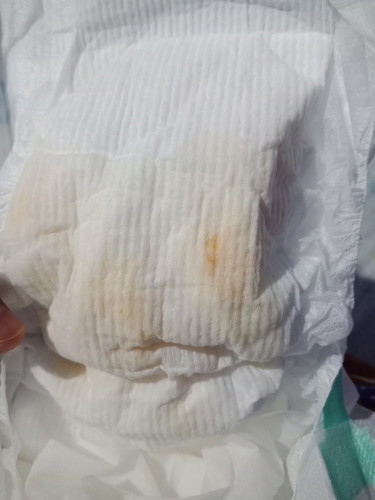 ฉี่ของลูก