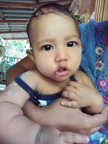 เด็กน้อย5เดือน