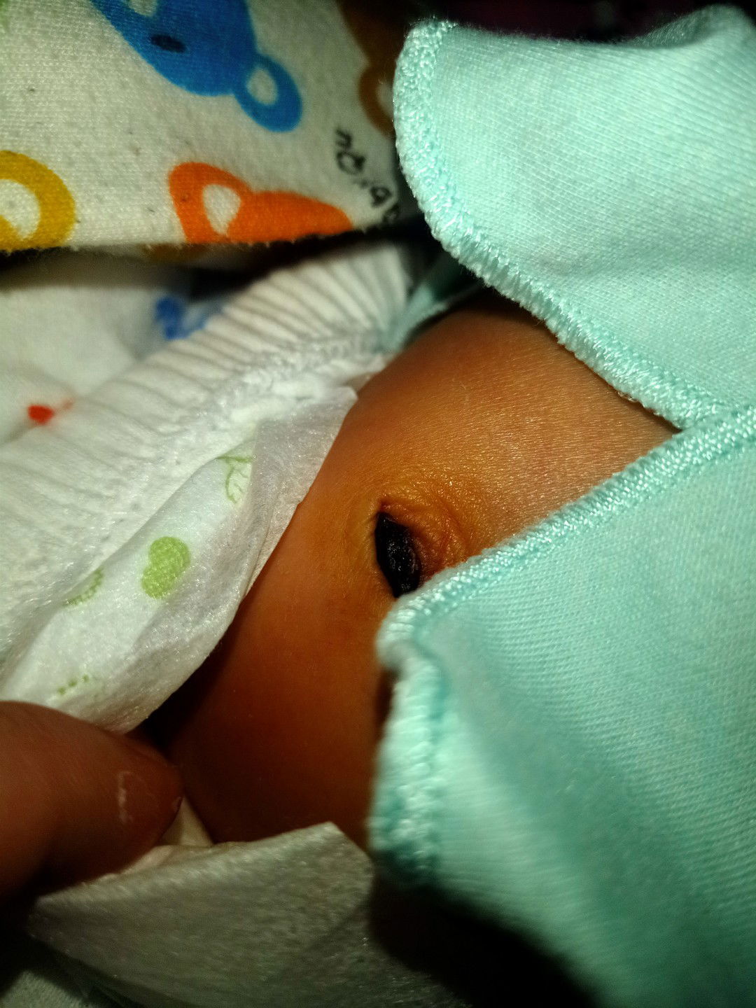 tali pusar Uda Puput koc masih ada hitam hitam nya ya