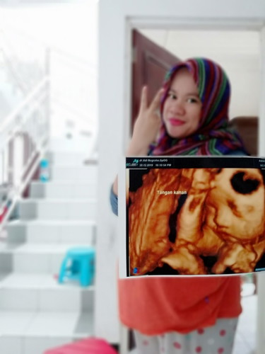 Lupa Gk Tny Dokter