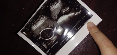 nak beza boy or girl