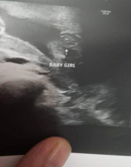 boy or girl