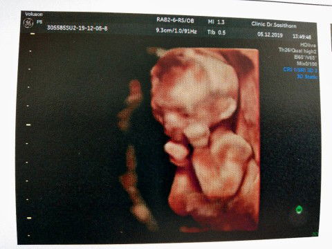 แอปแบ๋วยุ