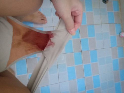 ปวดท้องมีเลือดออก