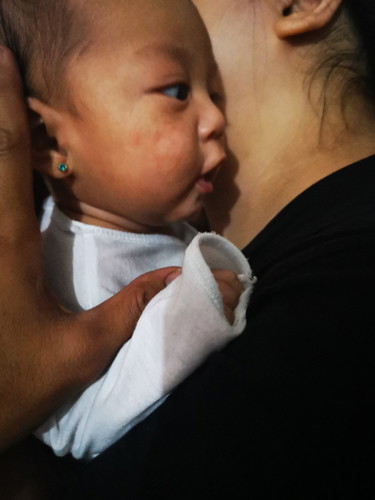 Ano Po Yun Nasa Mukha Ng Baby Po Namin